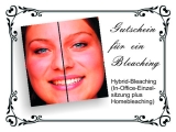 Hybrid-Bleaching: Kombi aus In-Office- und Homebleaching. Zahnaufhellung wie beim Zahnarzt, aber guenstig!